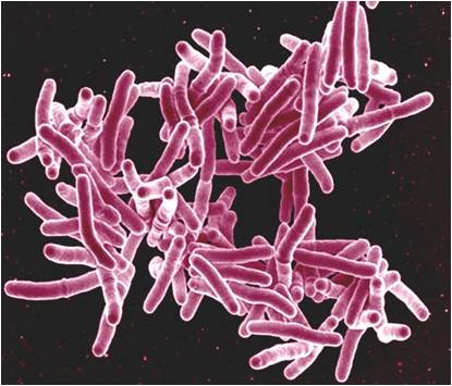 File:Mycobacterium Tuberculosis.jpg