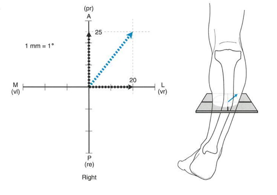 Fig. 10d