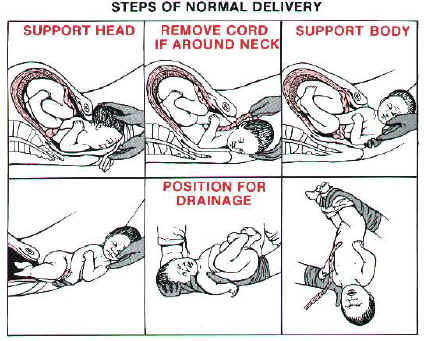 ChildbirthEM.jpg