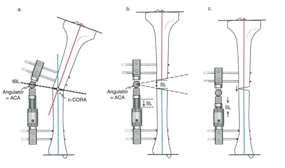 Fig. 11c