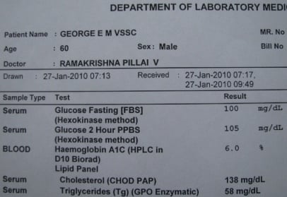 Blood sugar (FBS, PPBS & HbA1C) lab result printout after seven months of cure