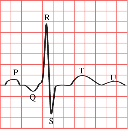 File:FCEMT-EKG Waveform Physiology.png