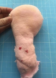 Step 1: Form the fundus