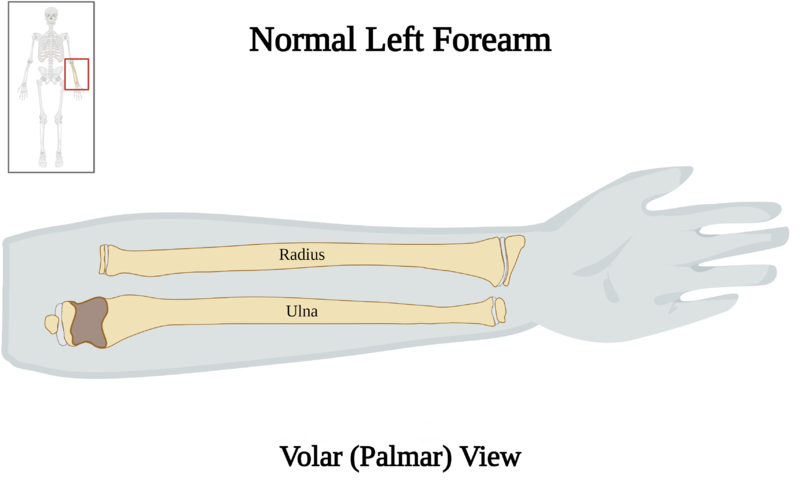 File:Normal Left Forearm of 10 y.o. Female - Volar View.png