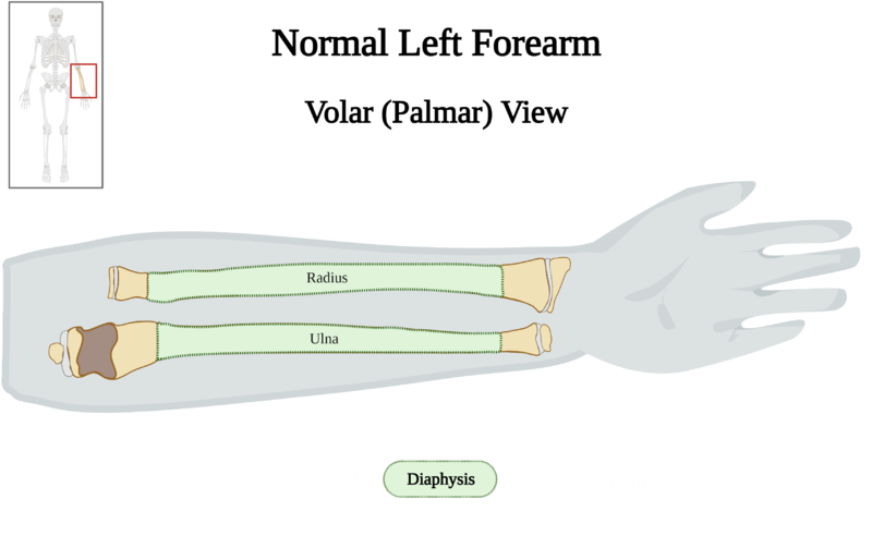 File:Normal Left Forearm of 10 y.o. Female - Diaphysis v2.0.png