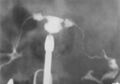 Thumbnail for version as of 05:09, 18 March 2026