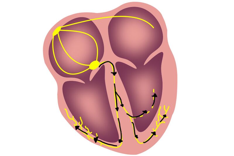 File:FCEMT-QRS-Heart.jpg