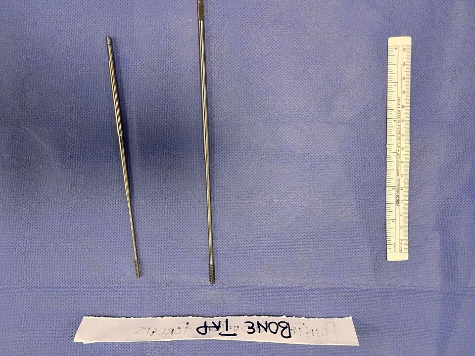 File:Bone tap 1.jpg
