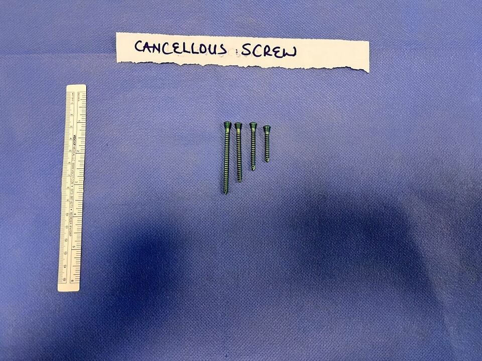 File:Cancellous screw 1.jpg