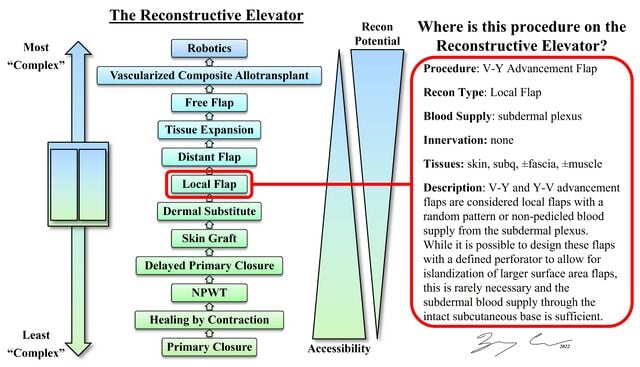 640px-V-Y_Recon_Elevator.jpg