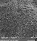 Fig1. b)Sand-blasted titanium surface with biocompatible agent particle sizes 150 μm.jpg