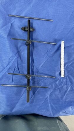 External fixator system, view 2