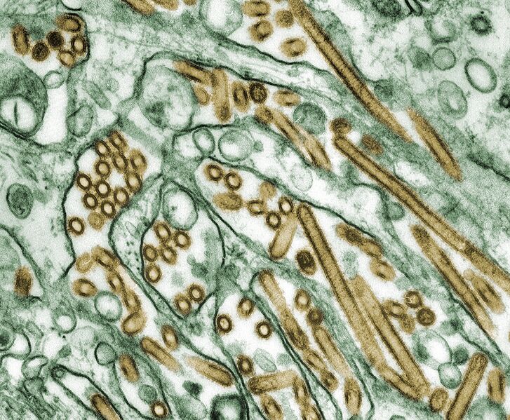 File:H5N1 virus.jpg