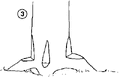 Thumbnail for version as of 01:26, 6 January 2007