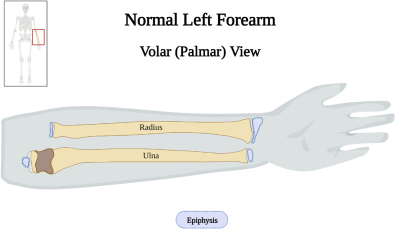 File:Normal Left Forearm of 10 y.o. Female - Epiphysis v2.0.png