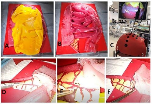 Six-panel photograph of the silicone laparoscopic appendectomy simulator: model on retroperitoneal base covered in yellow omentum sheet (A), bowel and appendix anatomy visible after omentum retraction (B), model inside a laparoscopic box trainer (C), and laparoscopic views of cecum retraction (D), mesoappendix division and artery clipping (E) and endoloop placement (F).