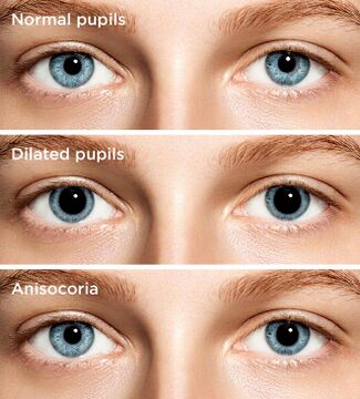 allaboutvision.com