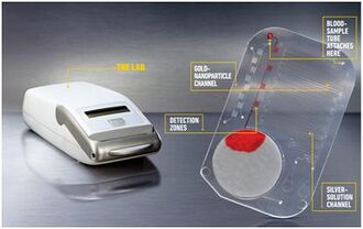 330px-Mchip.jpg