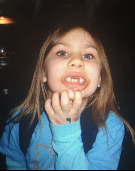 File:Toothmoreorlesss.jpg