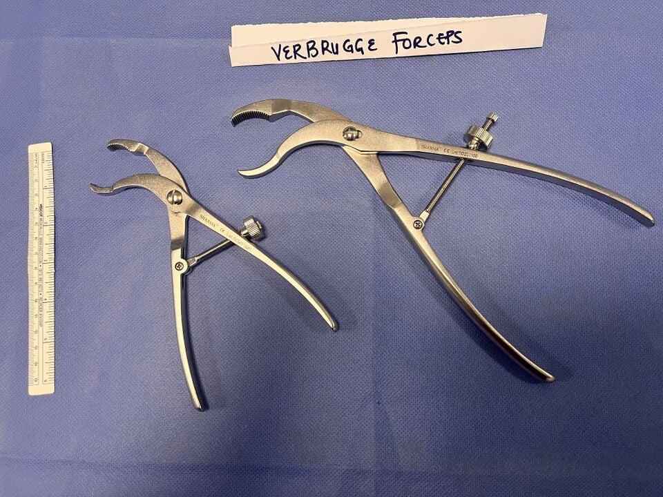 File:Verbrugge forceps 1.jpg