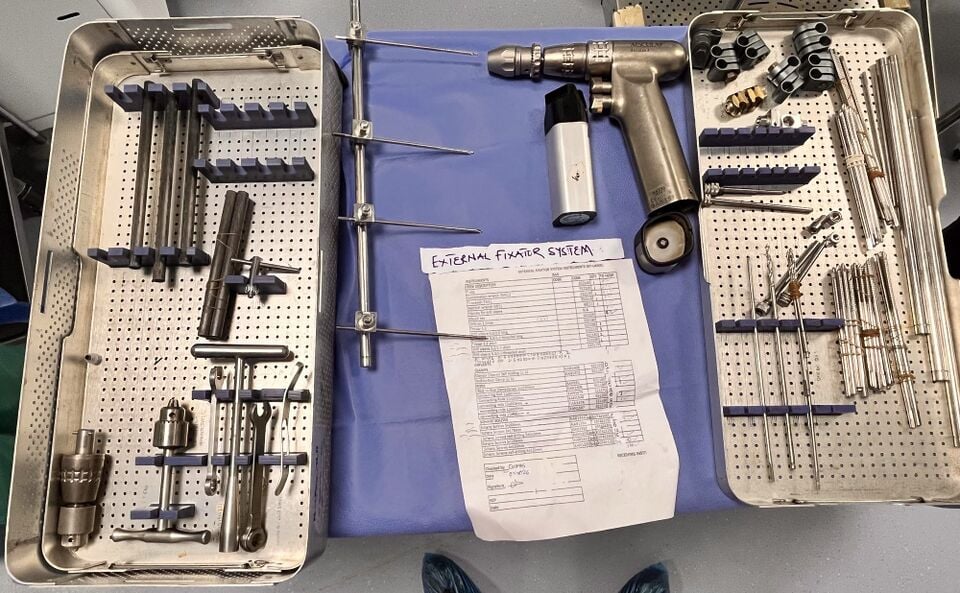 External fixator system, view 1