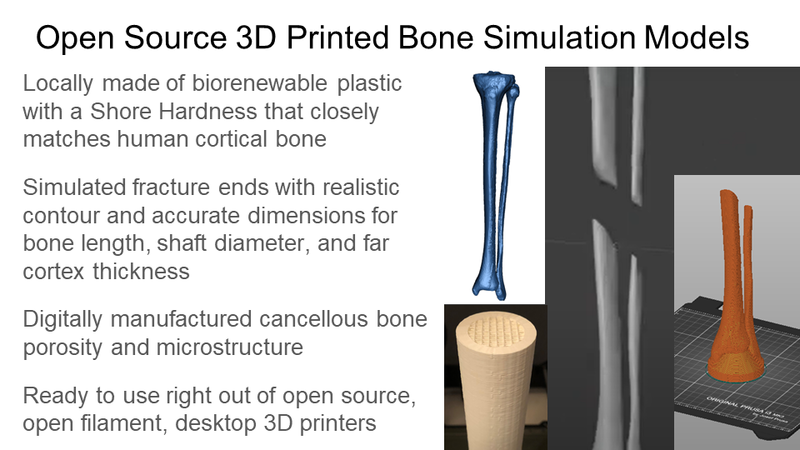 File:Medical Makers GSTC Tibial Fracture Fixation Project - Open Source 3D Printed Bone Simulation Models.png