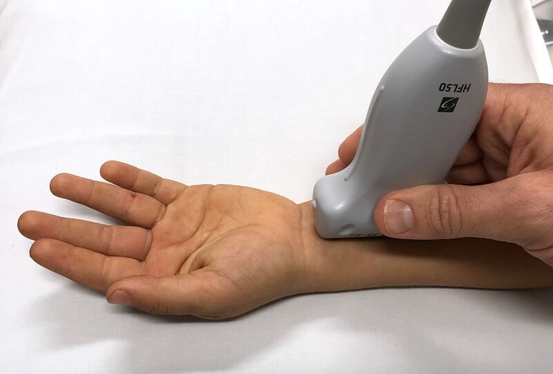 File:Supinated Forearm for Ultrasound Scanning.jpeg