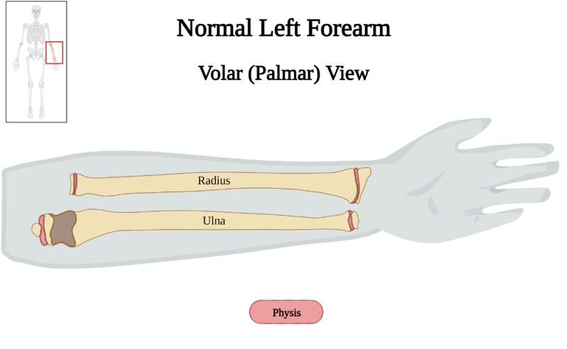 File:Normal Left Forearm of 10 y.o. Female - Physis v2.0.png