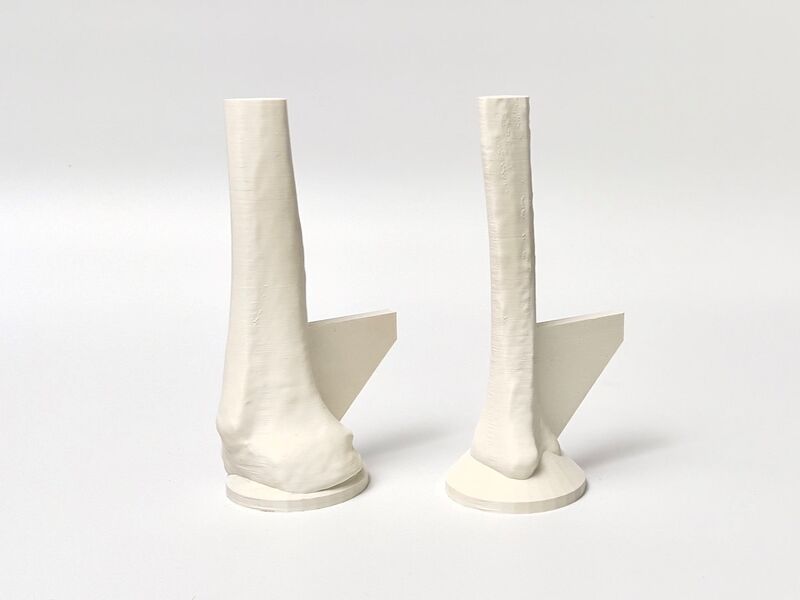 File:3D Printed Adult Female Tibial Bone Models 1 and 2.JPG