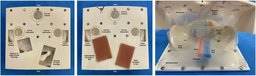 Three photographs of a white 3D-printed infant torso base: empty, with two tissue cartridges fitted, and viewed from inside with the abdominal wall lifted to show labelled printed vessels and pelvic anatomy.