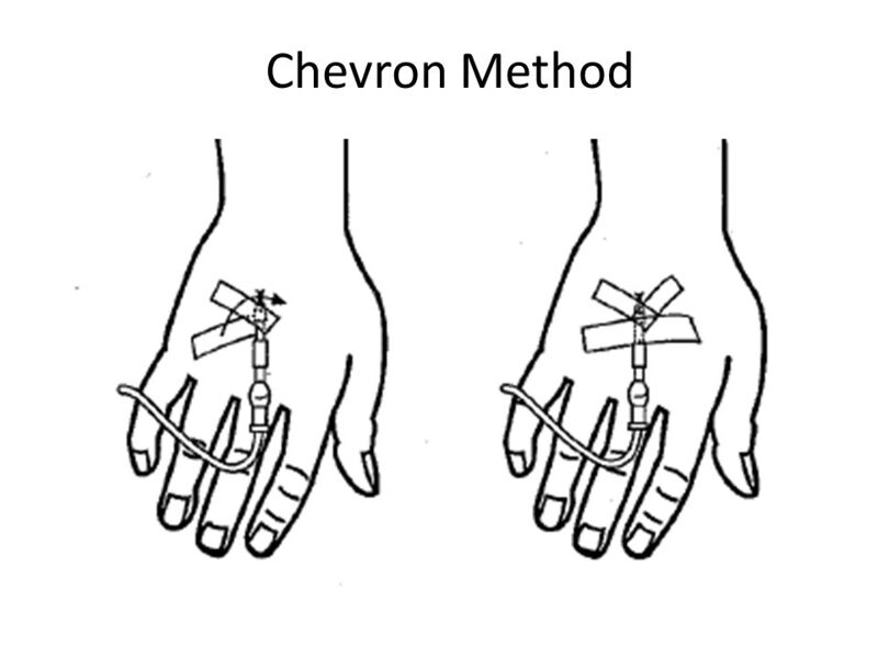 File:FCEMT-IV Chevron.jpg