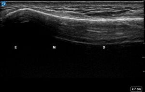 Ultrasound Labelled Scan - Dorsal Radius - Healthy Adult.jpg