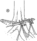 Thumbnail for version as of 01:26, 6 January 2007