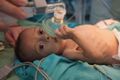 होंडुरास में बंधाव से पहले पीडीए से पीड़ित 15 महीने का बच्चा