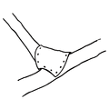 Thumbnail for version as of 23:50, 3 October 2006
