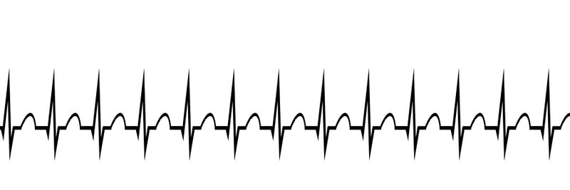 File:FCEMT-Supraventricular-Tachycardia.jpg