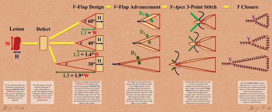 V-Y Angle Geometry.jpg