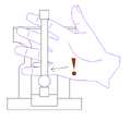 Fig. 2 : Doigt coincé dans l'étau d'établi.