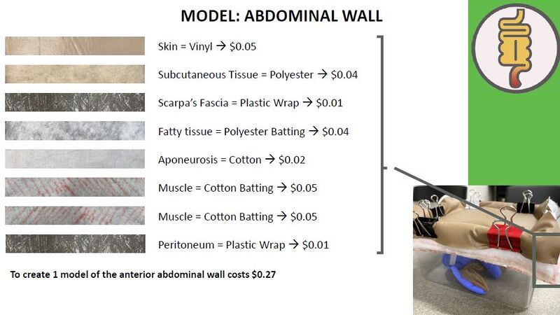 File:Anterior Abdominal Wall Cost.jpg